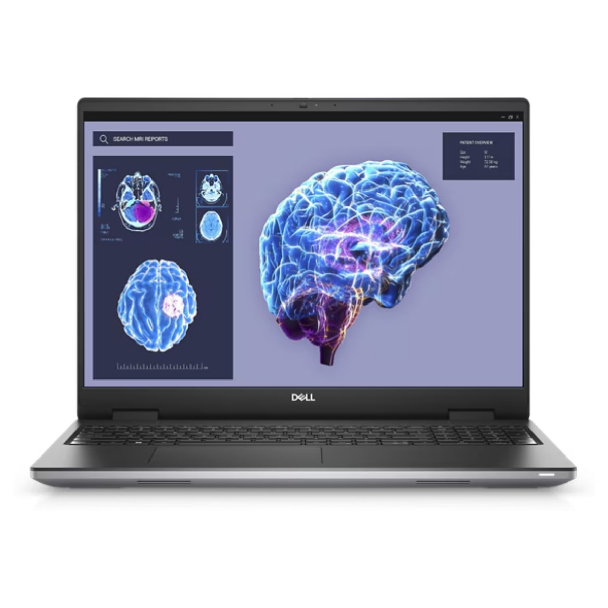 dell-precision-76808